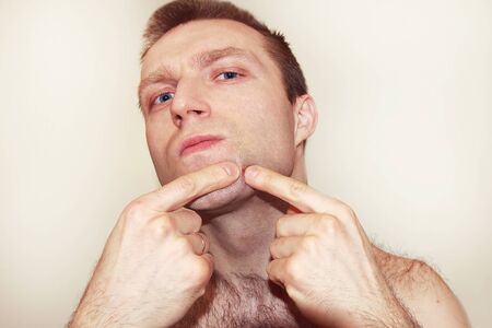 A man presses a pimple, bad skin on a white background. Skin problems, acne, skin care. Before the mirror, cleanse the skin.の写真素材