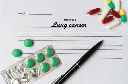 Lung cancer diagnosis written on a white piece of paper. Medical conceptの写真素材