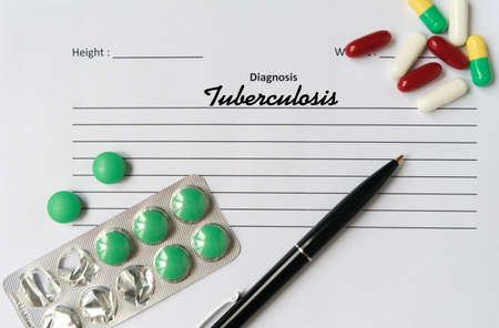 Tuberculosis diagnosis written on a white piece of paper. Medical conceptの写真素材