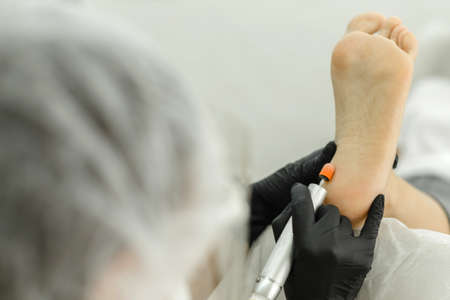 Master hardware pedicure during operation. Nail processing and milling. Close-up