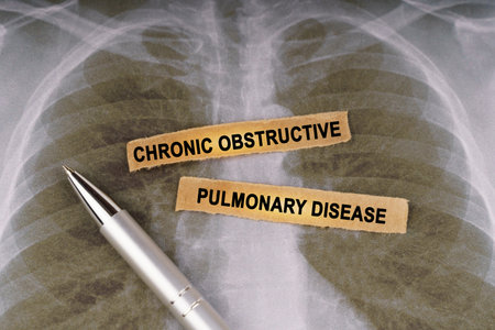 medical concept. On a human chest x-ray, a pen and strips of paper labeled - CHRONIC OBSTRUCTIVE PULMONARY DISEASEの写真素材