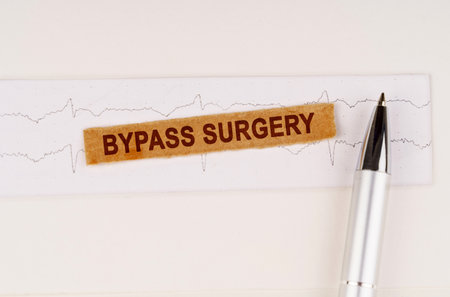 medical concept. On the cardiogram lies a pen and torn paper with the text - Bypass Surgery