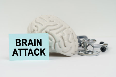 Medical concept. On a white surface next to the brain there is a stethoscope and stickers with the inscription - BRAIN ATTACKの写真素材