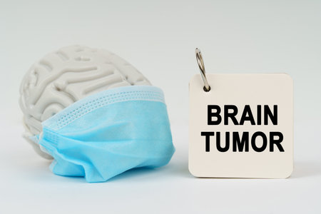 Medical concept. On a white surface there is a brain with a blue mask and a notepad with the inscription - Brain tumorの写真素材