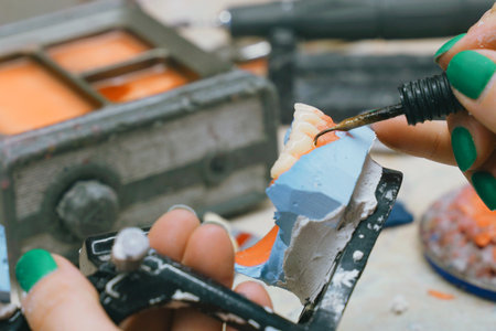 A dental technician is seen soldering, melting, and forming a tooth for dentures with hands in...