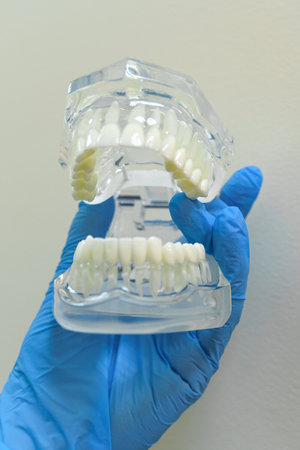 A close-up view of a dental model featuring immaculate teeth held in a gloved hand. The model...