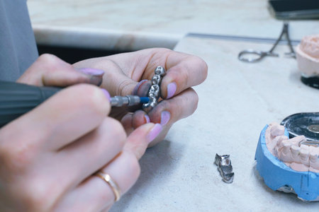 Focused on the delicate task, a dental technician expertly grinds metal dentures with precision tools.の写真素材