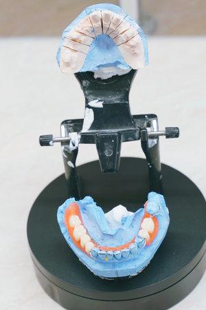 Crafted denture model demonstrates advanced dental techniques, featuring a meticulous design showing upper and lower arches. The laboratory environment reflects a focus on dental artistry.の写真素材