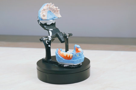 This denture model illustrates intricate dental work in a laboratory environment, highlighting the...