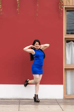 Woman with prosthetic leg is happy about her conditionの写真素材