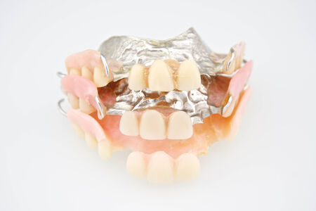 Stack of denture made from plastic and metal put on white background.の写真素材