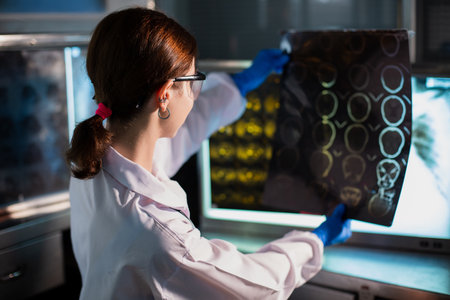 Doctor woman looking check up x-ray film in medical laboratory at hospital. Anatomy diagnostic...