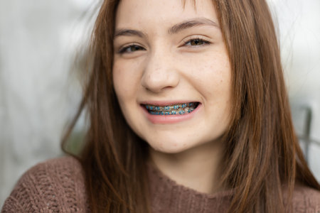 Close up portrait of face young caucasian beautiful woman blond hair smiling with braces. Happy girl in good mood smile showing teeth looking at camera.の写真素材