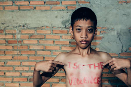 Stop abusing boy violence. violence, child bondage, Human Rights Day concept.の写真素材