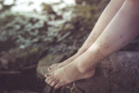 Women violence and abused concept. trafficking Concept. stop violence against Women. international women's day.の写真素材