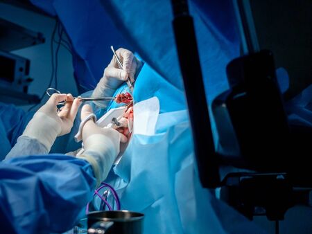 Bloodied hands of surgeons in sterile latex gloves with surgical instruments with traces of blood. The process of performing surgical coloproctological surgery.の写真素材