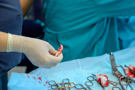 Close-up of a bloody gauze swab in the hand of a doctor in a sterile glove. Medical instruments on a blurred background. Surgery.の写真素材