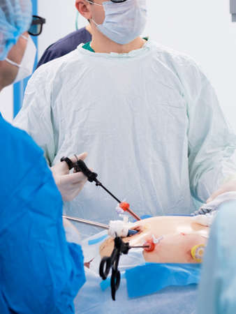 Surgeons wearing latex gloves and blue uniforms perform laparoscopic minimally invasive surgery using special medical instruments. Treatment of proctological diseases.の写真素材