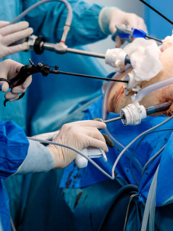 Selective focus on the hand of a surgeon wearing a sterile latex glove holding a special medical instrument during laparoscopic surgery. Minimally invasive surgical treatment.の写真素材