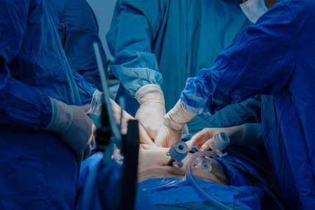 Selective focus on the hand of a surgeon wearing a sterile latex glove holding a special medical...