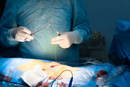 The surgeons hands suture the patients skin. The doctors hands in sterile gloves operate with a...