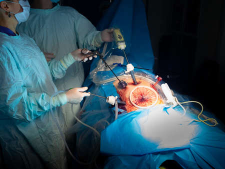 The hands of surgeons perform a surgical operation using surgical manipulators. Selective focus. Laparoscopic minimally invasive surgery.の写真素材