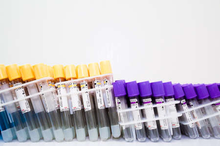 Moscow. Russia. December 24, 2021. Many of transparent sterile medical vacuum blood test tubesのeditorial素材