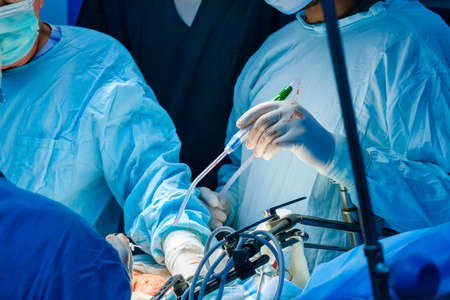 Close-up of the hands of surgeons in gloves in the operating room. Selective focus. A catheter for suctioning blood in the surgeons hand during surgery.の写真素材