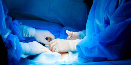 A team of surgeons in a blue surgical uniform and white sterile gloves operate on a patient. Selective focus.の写真素材