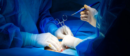 A team of surgeons in blue surgical uniforms and white sterile gloves use surgical instruments...