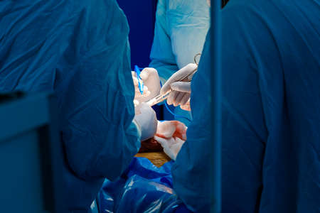 Hands of surgeons with surgical instruments during a surgical operation. Selective focus.の写真素材