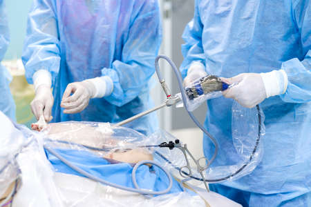 Selective focus on laparoscopic instruments in the hands of doctors during a surgical operation. A team of surgeons operates on a patient on an operating table. Minimally invasive surgery.の写真素材