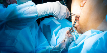 Doctors hands in sterile surgical gloves carry out surgical treatment of hemorrhoids on the patients anus. Selective focus.の写真素材