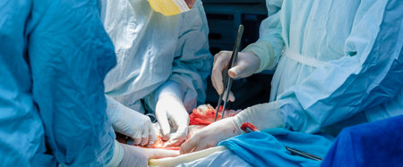 A team of surgeons performs a surgical operation. Selective focus on the hands of surgeons in...