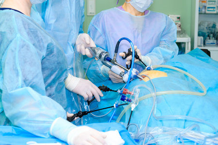 Hands of surgeons in sterile gloves with laparoscopic surgical manipulators during proctologic surgery.の写真素材