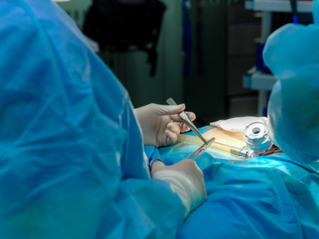 Surgical scissors and tweezers in the hands of a surgeon during a surgical operation. Doctors hands in sterile gloves hold surgical instruments during surgery. Selective focus.の写真素材