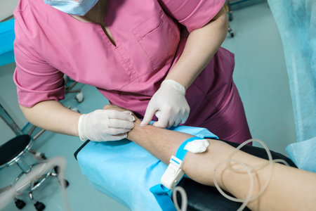 A doctor in sterile gloves inserts a needle into the patients arm to install a dropper catheter.の写真素材