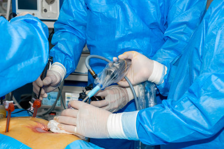 A team of doctors performs laparoscopic surgery in the operating room. Surgeons' hands hold surgical manipulators for minimally invasive endoscopic surgery with light effect.の写真素材