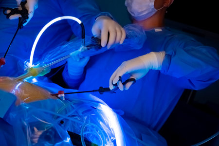 Doctors perform laparoscopic surgery in a hospital operating room in the dark. Surgeons use light to illuminate the patients abdominal cavity. Minimally invasive surgery. Selective focus.の写真素材