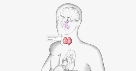 Hashimoto's thyroiditis is an autoimmune condition characterized by inadequate production of thyroid hormones. 3D renderingの写真素材