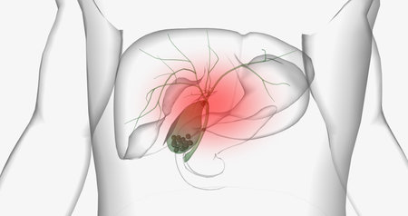 Gallstones are pieces of solid material that form in the gallbladder, a small hollow organ located beneath the liver. 3D renderingの写真素材