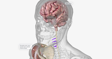 Amyotropic lateral sclerosis (ALS) is a progressive neurodegenerative disorder caused by the death of motor neurons. 3D renderingの写真素材