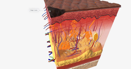 In Stage I ALM, the tumor is very small and located on the top-most layer of the skin, the epidermis. 3D renderingの写真素材