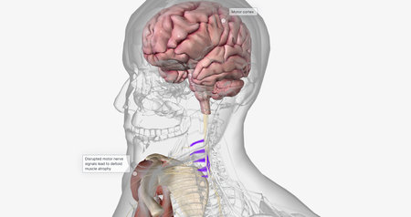 Amyotropic lateral sclerosis (ALS) is a progressive neurodegenerative disorder caused by the death of motor neurons. 3D renderingの写真素材