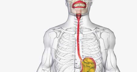 Acid reflux is caused by the involuntary release of stomach acid into the esophagus, throat, and mouth. 3D renderingの写真素材