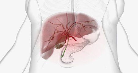 Gallstones are pieces of solid material that form in the gallbladder, a small hollow organ located...