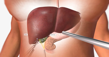 Locating and Retracting the Gallbladder 3D renderingの写真素材