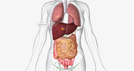 Stage IV ovarian cancer has spread to distant sites such as the lungs and liver. 3D renderingの写真素材