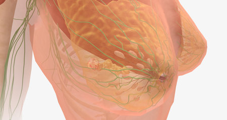 Stage III breast tumors are invasive and have spread to the lymph nodes around the collar bone or those deep within the breast. 3D renderingの写真素材