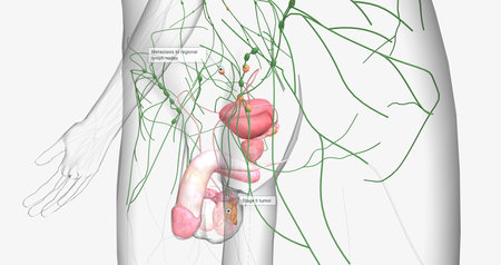 Stage II testicular cancer is characterized by the spread of cancer to nearby regional lymph nodes. 3D renderingの写真素材